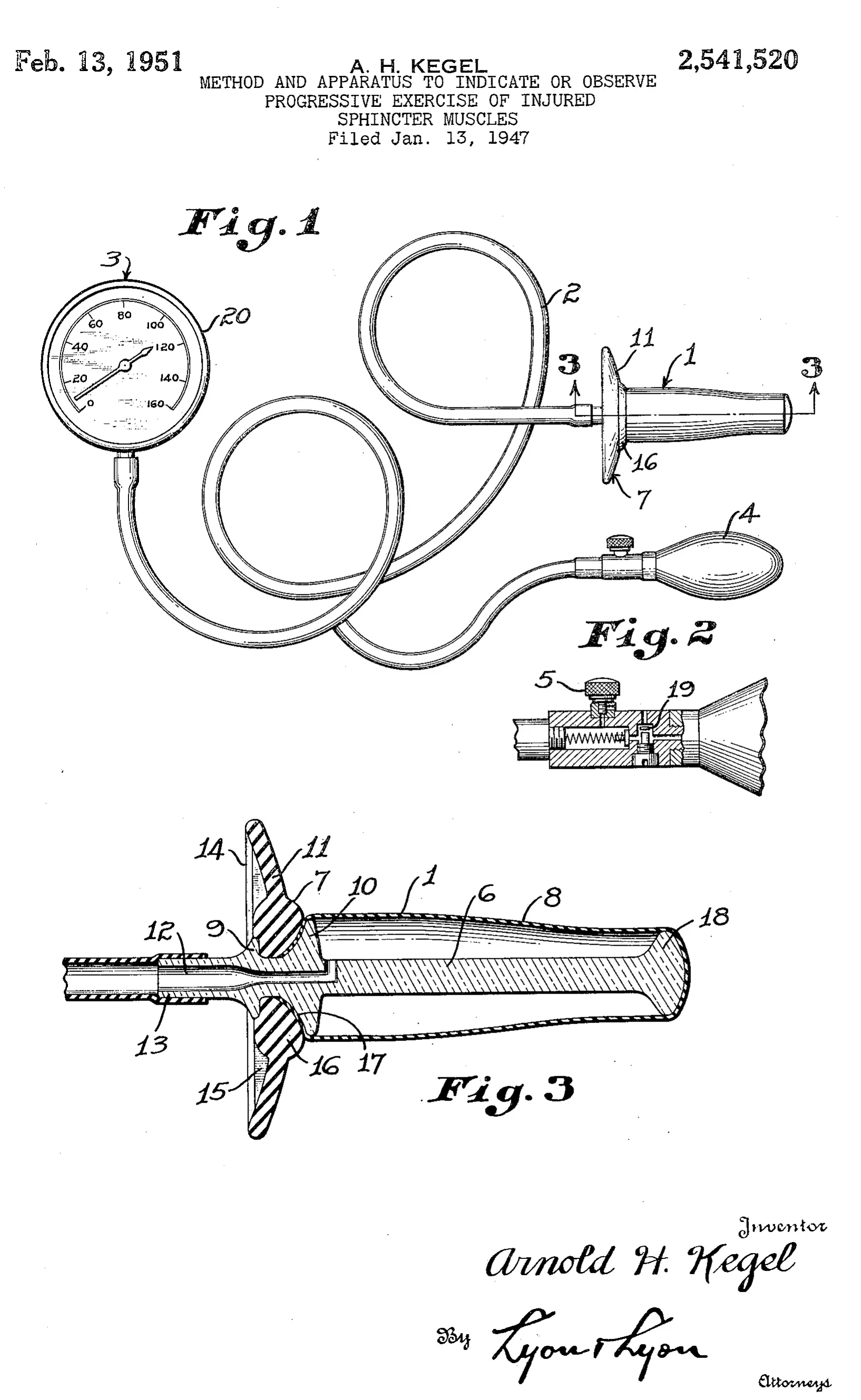 Desenho da patente do perineômetro de Arnold H. Kegel, de 1951: o manômetro, o tubo, a pera de borracha e a sonda, com a assinatura dele embaixo